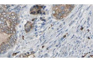 ABIN6276960 at 1/100 staining Human prostate tissue by IHC-P. (TNNC1 抗体  (Internal Region))