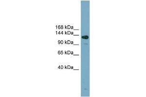 WB Suggested Anti-ASXL2  Antibody Titration: 0. (ASXL2 抗体  (Middle Region))