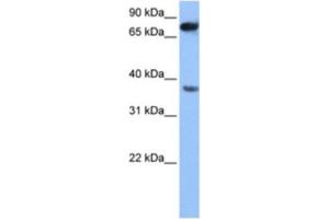 Western Blotting (WB) image for anti-Zinc Finger, CCHC Domain Containing 12 (ZCCHC12) antibody (ABIN2463550) (ZCCHC12 抗体)