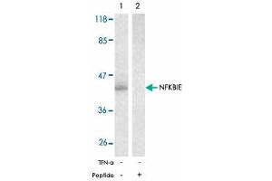 Western blot analysis of extracts from 293 cells untreated or treated with TNF-alpha (20 ng/mL, 15 min) using NFKBIE polyclonal antibody . (NFKBIE 抗体)