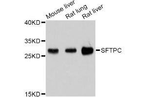 Western blot analysis of extracts of various cell lines, using SFTPC Antibody (ABIN4905145) at 1:1000 dilution. (Surfactant Protein C 抗体)