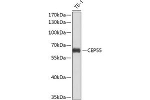 Western blot analysis of extracts of THP-1 cells, using CEP55 antibody (ABIN6127692, ABIN6138423, ABIN6138424 and ABIN6224249) at 1:1000 dilution. (CEP55 抗体  (AA 1-260))