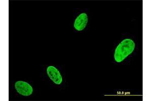 Immunofluorescence of monoclonal antibody to RUNX2 on U-2 OS cell. (RUNX2 抗体  (AA 251-350))