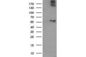 Western Blotting (WB) image for anti-Acyl-CoA Thioesterase 12 (ACOT12) antibody (ABIN1496414) (ACOT12 抗体)