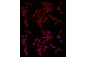 Immunofluorescence analysis of PC-12 cells using F Rabbit pAb (ABIN6127814, ABIN6140422, ABIN6140423 and ABIN6221993) at dilution of 1:200 (40x lens). (FABP5 抗体  (AA 1-135))