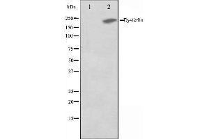 Western blot analysis on K562 cell lysate using Dysferlin Antibody,The lane on the left is treated with the antigen-specific peptide. (Dysferlin 抗体  (C-Term))