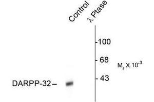 Image no. 1 for anti-Protein Phosphatase 1, Regulatory (Inhibitor) Subunit 1B (PPP1R1B) (pThr34) antibody (ABIN372606) (DARPP32 抗体  (pThr34))