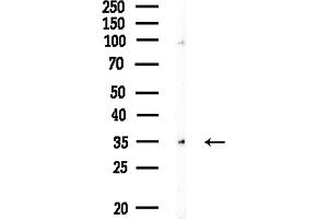 anti-Sphingosine-1-Phosphate Receptor 2 (S1PR2) (Internal Region) antibody