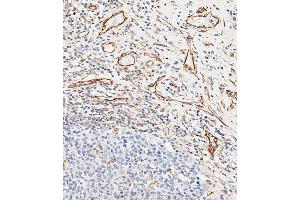 Immunohistochemical analysis of paraffin-embedded human appendix tissue using (ABIN658983 and ABIN2838032) performed on the Leica® BOND RXm. (CD34 抗体  (AA 185-214))