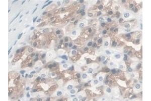 DAB staining on IHC-P; Samples: Rat Stomach Tissue (S100A16 抗体  (AA 1-97))