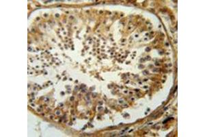 Immunohistochemistry analysis in human testis carcinoma (Formalin-fixed, Paraffin-embedded) using SERAC1  Antibody  (C-term), followed by peroxidase conjugation of the secondary antibody and DAB staining. (SERAC1 抗体  (C-Term))