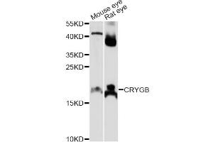 Western blot analysis of extracts of various cell lines, using CRYGB antibody (ABIN6292463) at 1:1000 dilution.