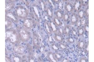 Detection of FARS2 in Rat Kidney Tissue using Polyclonal Antibody to Phenylalanyl tRNA Synthetase 2, Mitochondrial (FARS2) (FARS2 抗体)