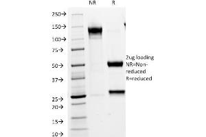 SDS-PAGE Analysis Purified VLDL-Receptor Mouse Monoclonal Antibody (VLDLR/1337). (VLDLR 抗体  (C-Term))