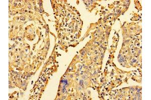 Immunohistochemistry (IHC) image for anti-Dynein, Light Chain, LC8-Type 1 (DYNLL1) (AA 1-89) antibody (ABIN7150882)