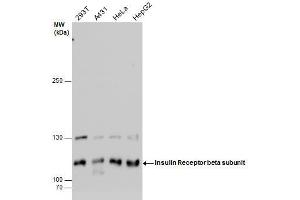 WB Image Insulin Receptor beta subunit antibody detects Insulin Receptor beta subunit protein by western blot analysis. (Insulin Receptor 抗体  (C-Term))