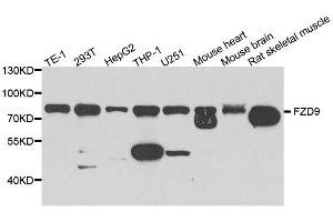 Western blot analysis of extracts of various cell lines, using FZD9 antibody. (FZD9 抗体  (AA 469-591))