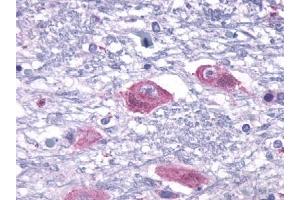 Immunohistochemical staining of Brain (Neurons and glia) using anti- PTHR2 antibody ABIN122362 (PTH2R 抗体  (Extracellular Domain))