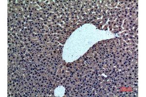 Immunohistochemistry (IHC) analysis of paraffin-embedded Rat liver, antibody was diluted at 1:100. (Prothrombin 抗体  (Internal Region))