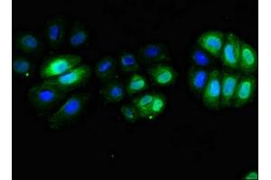 Immunofluorescent analysis of A549 cells using ABIN7171382 at dilution of 1:100 and Alexa Fluor 488-congugated AffiniPure Goat Anti-Rabbit IgG(H+L) (CD3 epsilon 抗体  (AA 23-126))