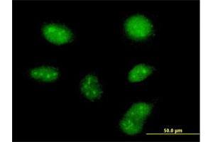 Immunofluorescence (IF) image for anti-Zinc Finger, C3HC-Type Containing 13 (ZCCHC13) (AA 1-166) antibody (ABIN949968)