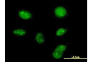Immunofluorescence of purified MaxPab antibody to ZCCHC13 on HeLa cell. (ZCCHC13 抗体  (AA 1-166))
