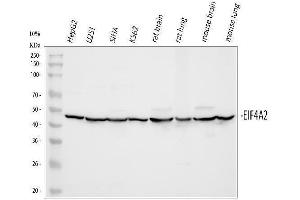 Western blot analysis of eIF4A2 using anti-eIF4A2 antibody (ABIN3043426). (EIF4A2 抗体  (N-Term))
