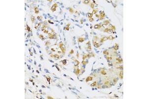 Immunohistochemistry of paraffin-embedded human stomach using RNASE3 antibody. (RNASE3 抗体)