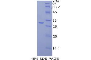 SDS-PAGE analysis of Chicken Fatty Acid Synthase Protein. (Fatty Acid Synthase Protein (FASN))