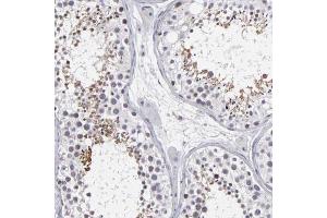 Immunohistochemical staining (Formalin-fixed paraffin-embedded sections) of human testis shows moderate cytoplasmic and nuclear positivity in seminiferous ducts with ODF2 polyclonal antibody . (ODF2 抗体  (AA 44-205))