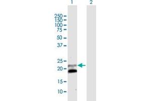 Western Blot analysis of IFNB1 expression in transfected 293T cell line by IFNB1 MaxPab polyclonal antibody. (IFNB1 抗体  (AA 1-187))