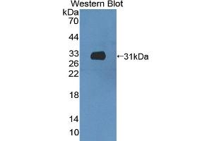 Detection of Recombinant CCDC60, Mouse using Polyclonal Antibody to Coiled Coil Domain Containing Protein 60 (CCDC60) (CCDC60 抗体  (AA 1-186))