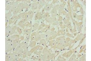 Immunohistochemistry of paraffin-embedded human heart tissue using ABIN7157743 at dilution of 1:100 (KCNIP2 抗体  (AA 1-90))