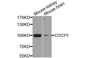 Western blot analysis of extracts of various cell lines, using CDCP1 antibody. (CDCP1 抗体  (AA 30-343))