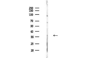 Western blot analysis of lysates from COLO205 cells(UV,30 min treatment), using MKX Antibody at 1/1000 dilution.