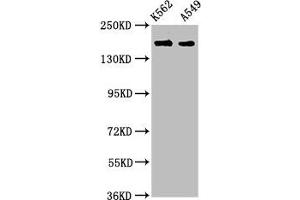 Western Blot Positive WB detected in: K562 whole cell lysate, A549 whole cell lysate All lanes: FMN1 antibody at 3. (FMN1 抗体  (AA 354-487))