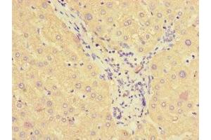 Immunohistochemistry of paraffin-embedded human liver tissue using ABIN7170841 at dilution of 1:100 (SMAP1 抗体  (AA 1-280))