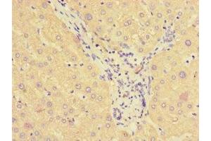 Immunohistochemistry of paraffin-embedded human liver tissue using ABIN7170841 at dilution of 1:100 (SMAP1 抗体  (AA 1-280))