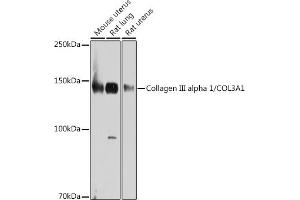 Western blot analysis of extracts of various cell lines, using Collagen III alpha 1/COL3 antibody (ABIN7266459) at 1:1000 dilution. (COL3 抗体)