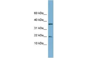 WB Suggested Anti-DUSP10 Antibody Titration: 0. (DUSP10 抗体  (N-Term))