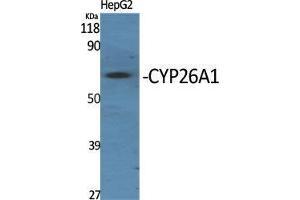 Western Blot (WB) analysis of specific cells using CYP26A1 Polyclonal Antibody.