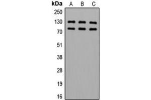 Western blot analysis of Alpha-adducin (pS726/713) expression in HeLa (A), SP2/0 (B), PC12 (C) whole cell lysates. (alpha Adducin 抗体  (C-Term, pSer713, pSer726))