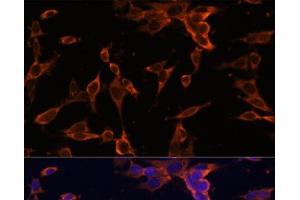 Immunofluorescence analysis of NIH-3T3 cells using USP36 Polyclonal Antibody at dilution of 1:100 (40x lens). (USP36 抗体)