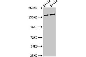 Western Blot Positive WB detected in: Rat brain tissue, Mouse brain tissue All lanes: MAST3 antibody at 3 μg/mL Secondary Goat polyclonal to rabbit IgG at 1/50000 dilution Predicted band size: 144 kDa Observed band size: 144 kDa (MAST3 抗体  (AA 1101-1309))
