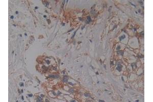 Immunohistochemistry (IHC) image for anti-Protein Kinase C, iota (PRKCI) (AA 375-596) antibody (ABIN7444109)