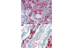 Immunohistochemical staining (Formalin-fixed paraffin-embedded sections) of human thymus tissue (A) and human small intestine tissue (B) using HLA Class II beta chains (DP, DQ, DR) monoclonal antibody, clone WR18  under 10 ug/mL working concentration. (HLA-DRB1 抗体)