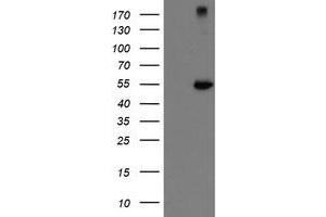 Western Blotting (WB) image for anti-rho GTPase Activating Protein 2 (ARHGAP2) antibody (ABIN1499629) (CHN1 抗体)