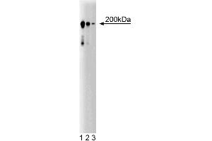 Western blot analysis of CD104 (Integrin beta4) on a A431 cell lysate (Human epithelial carcinoma, ATCC CRL-1555).