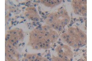 Detection of Rock2 in Human Stomach Tissue using Polyclonal Antibody to Rho Associated Coiled Coil Containing Protein Kinase 2 (Rock2) (ROCK2 抗体  (AA 904-1140))
