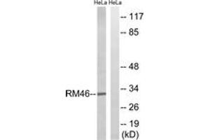 Western Blotting (WB) image for anti-Mitochondrial Ribosomal Protein L46 (MRPL46) (AA 111-160) antibody (ABIN2879174) (MRPL46 抗体  (AA 111-160))